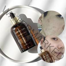 로리앤첼 글로리어스 에센스 앰플 세럼 80g, 80ml, 1개